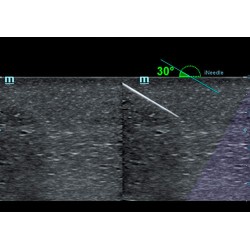 Ecógrafo Mindray M6 + sonda lineal o convexa
