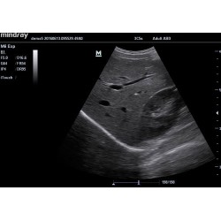 Ecógrafo Mindray M6 + sonda lineal o convexa