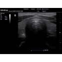 Ecógrafo Mindray M6 + sonda lineal o convexa