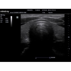 Ecógrafo Mindray M6 + sonda lineal o convexa