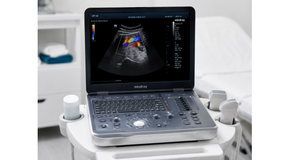 Ecógrafo Mindray DP30 con Color y PW: diagnóstico avanzado para fisioterapia y rehabilitación